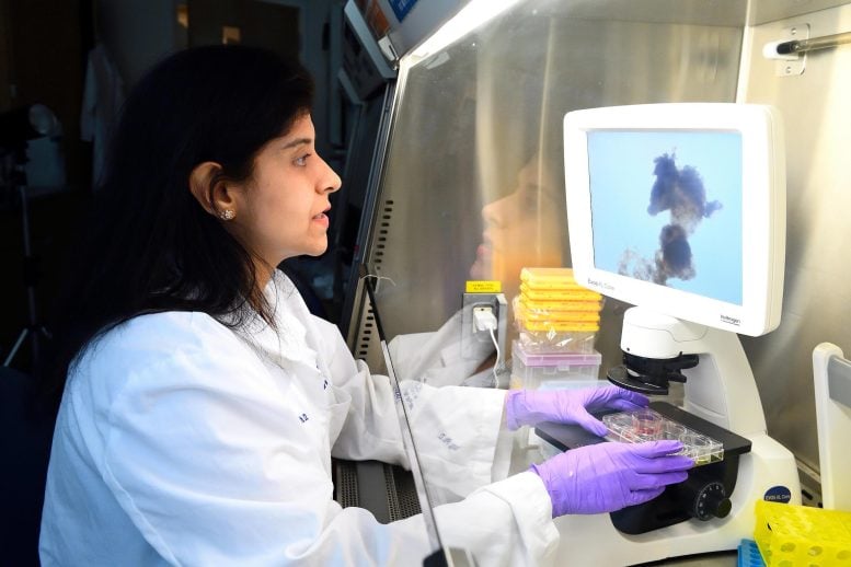 Scientists Discover Neural Basis of Schizophrenia and Bipolar Disorder -SciTechDaily.com